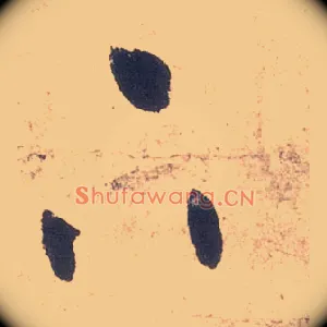 下
