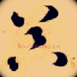 器